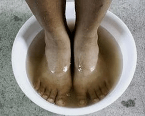 Rules for cure nail fungus