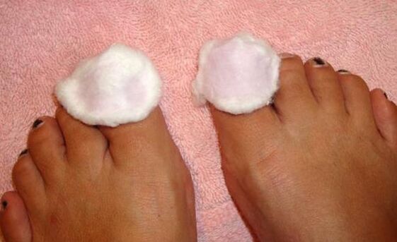 compress for the treatment of nail fungus