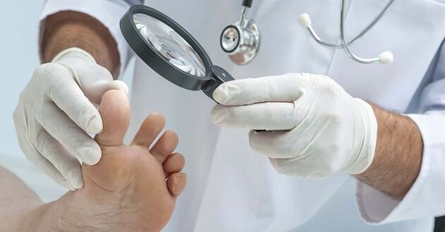 A doctor will prescribe medication for toenail fungus after diagnosing the disease