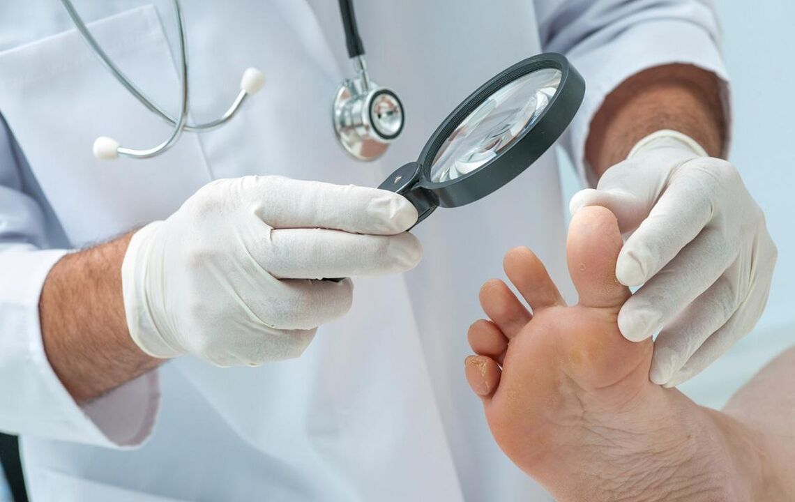 the doctor examines the nails for fungus